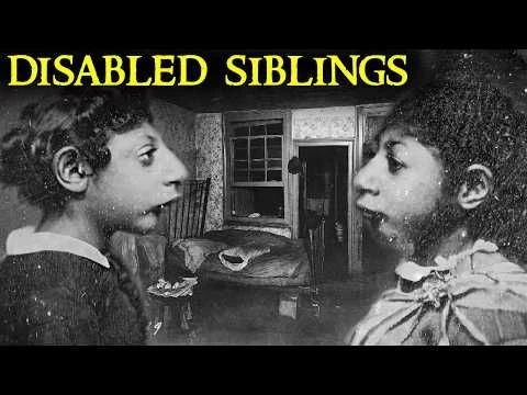 The Shocking Case of the Disabled “Aztec Children”