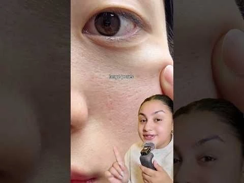 1 Pharmacy Cream for Multiple Skin Concerns ! #skincare #facedecor #bumpychin #openpores