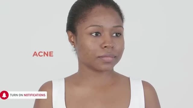 16 BEST 2 INGREDIENT FACE MASKS FOR CLEAR, GLOWING & HEALTHY SKIN